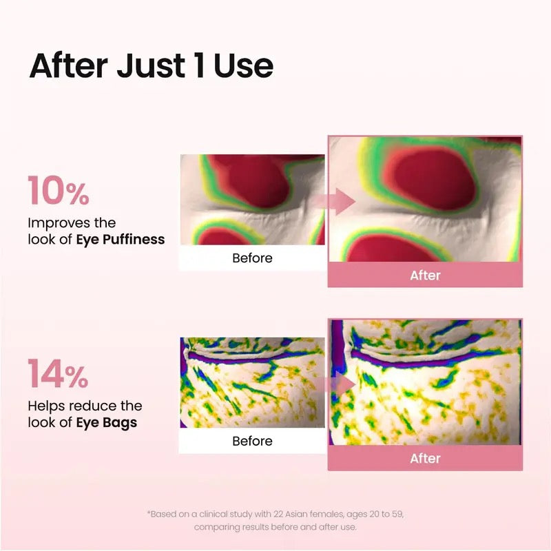 AMENI™ Collagen Peptide Eye Patch